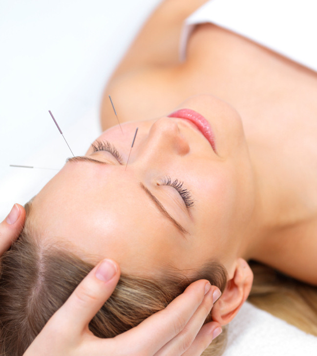 Bellevue Acupuncture